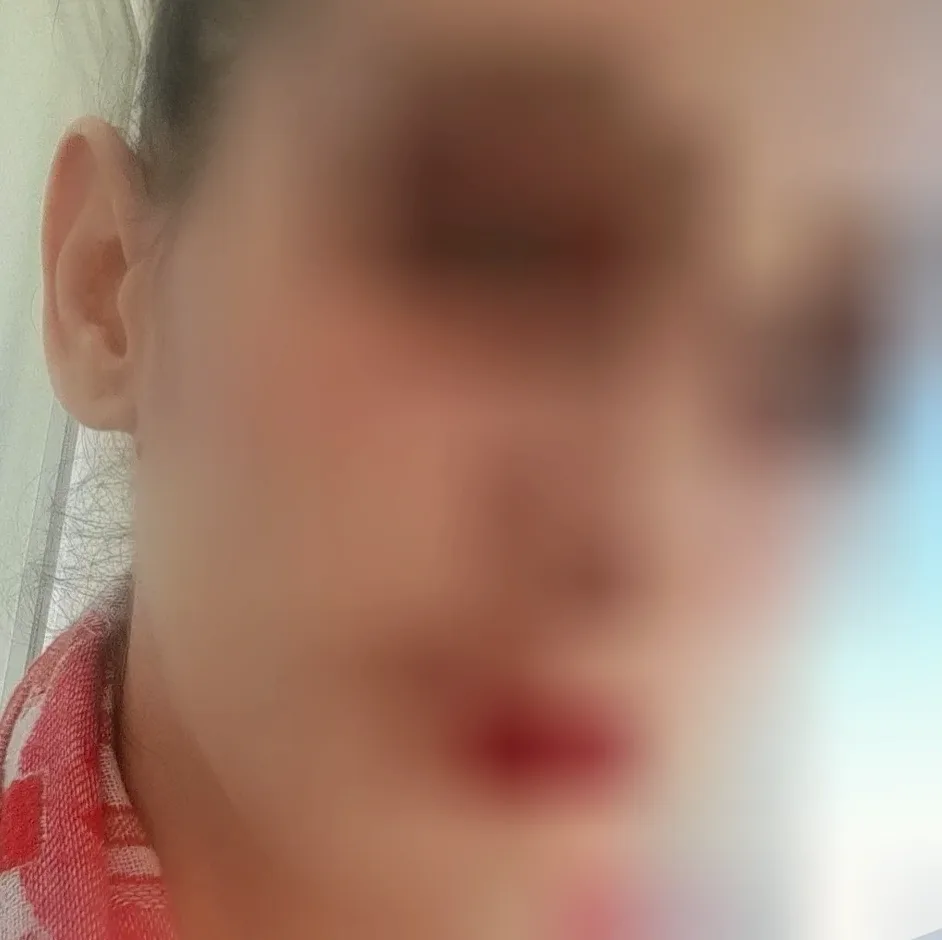 Therese, 37